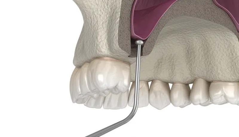 Dentista cerca de mí, dentista cerca de mí, mejor dentista de miami, mejor dentista de miami, pizza cerca de mí, chino cerca de mí, comida cerca de mí, dentista de corona en miami, dentista más barato en miami, dentista de tratamiento de conductos en miami, dentista de tratamiento de conductos en miami más barato